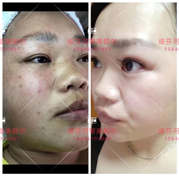 綏芬河黎美韻爾的圖標(biāo)