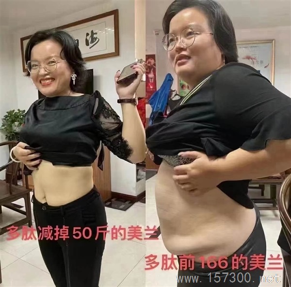 想減肥的聯(lián)系我