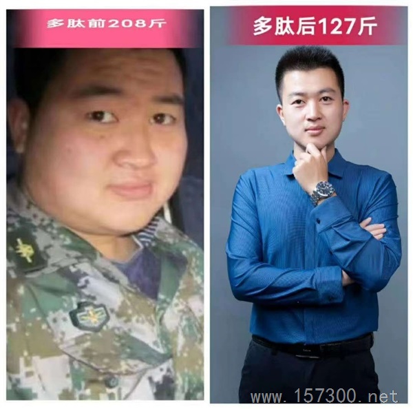 想減肥的聯(lián)系我